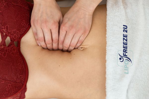 diastasis recti treatment Sale