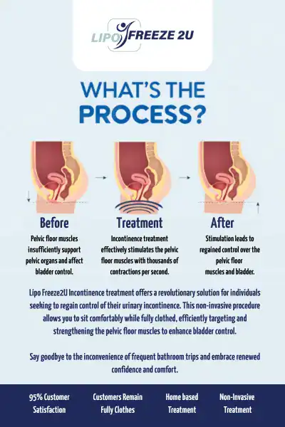 Diagram of how incontinence treatment Sale works.