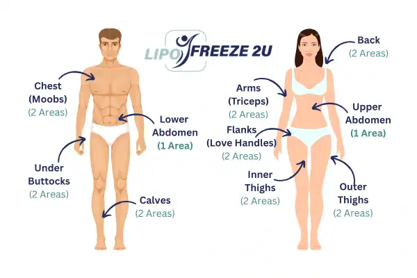 Areas you can have fat freezing treatment Sale
