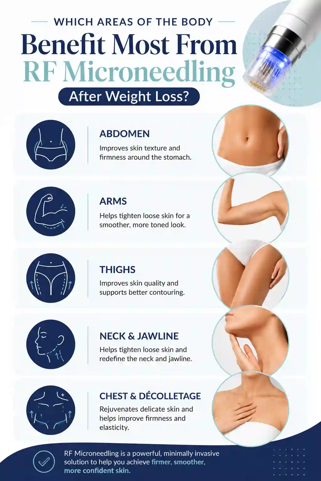 Which Areas of the Body Benefit Most From RF Microneedling After Weight Loss Sale